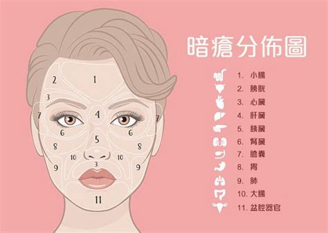 人中生瘡|9大暗瘡位置：下巴暗瘡=腎虧？中醫去暗瘡有用嗎？